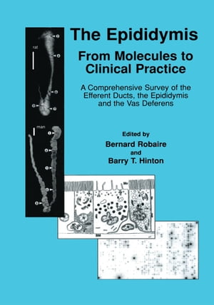 The Epididymis: From Molecules to Clinical Practice