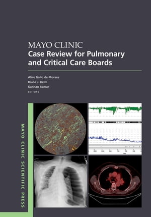 Mayo Clinic Case Review for Pulmonary and Critical Care Boards【電子書籍】[ Gallo de Moraes ]