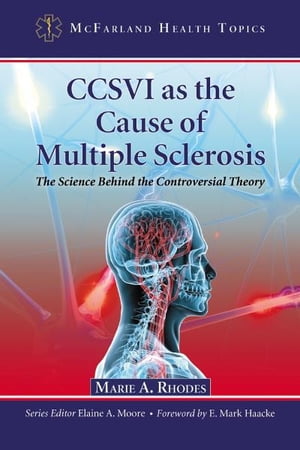 CCSVI as the Cause of Multiple Sclerosis The Science Behind the Controversial Theory