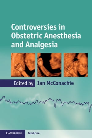 ŷKoboŻҽҥȥ㤨Controversies in Obstetric Anesthesia and AnalgesiaŻҽҡۡפβǤʤ10,289ߤˤʤޤ
