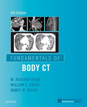 Fundamentals of Body CT E-Book