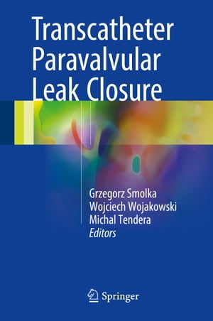 ŷKoboŻҽҥȥ㤨Transcatheter Paravalvular Leak ClosureŻҽҡۡפβǤʤ6,076ߤˤʤޤ