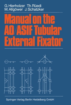 楽天楽天Kobo電子書籍ストアManual on the AO/ASIF Tubular External Fixator【電子書籍】[ G. Hierholzer ]