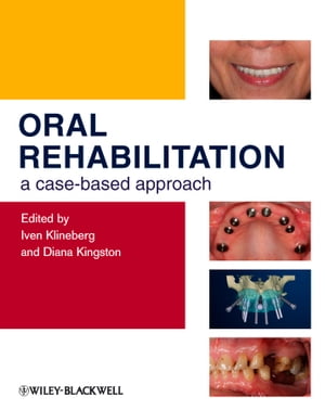 Oral Rehabilitation