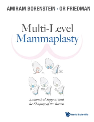 Multi-level Mammaplasty: Anatomical Support And Re-shaping Of The Breast