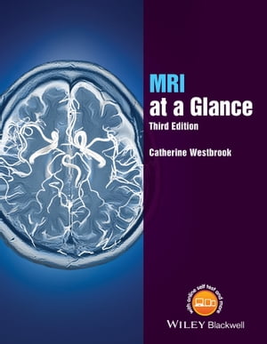 MRI at a Glance【電子書籍】 Catherine Westbrook