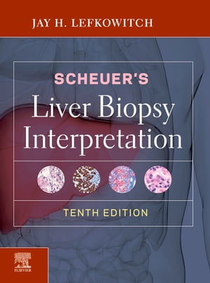 Scheuer's Liver Biopsy Interpretation【電子書籍】[ Jay H. Lefkowitch, MD ]