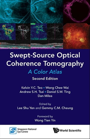 Swept-source Optical Coherence Tomography: A Color Atlas (Second Edition)