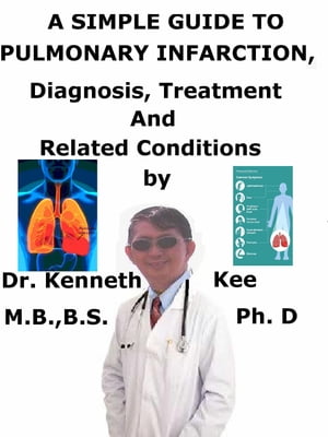 A Simple Guide to Pulmonary Infarction, Diagnosis, Treatment and Related Conditions