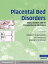 Placental Bed Disorders