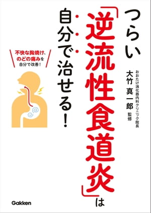 つらい「逆流性食道炎」は自分で治せる！