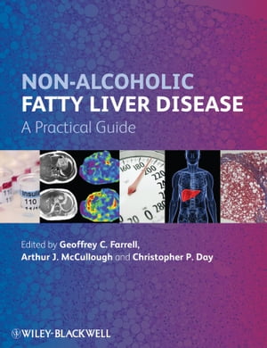Non-Alcoholic Fatty Liver Disease A Practical Guide【電子書籍】