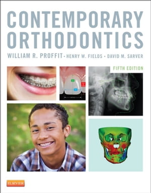 Contemporary Orthodontics - E-Book