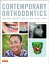 Contemporary Orthodontics - E-Book