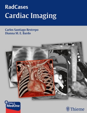 Radcases Cardiac Imaging