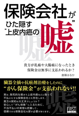 保険会社がひた隠す“上皮内癌の嘘”