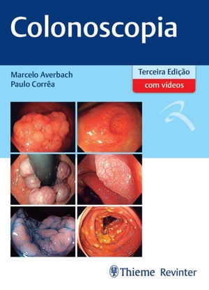 Colonoscopia【電子書籍】[ Marcelo Averbach ]