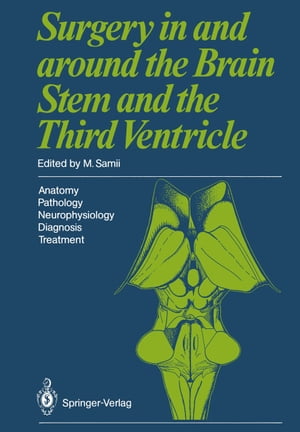 Surgery in and around the Brain Stem and the Third Ventricle Anatomy Pathology Neurophysiology Diagnosis Treatment【電子書籍】