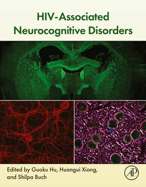 HIV-Associated Neurocognitive Disorders