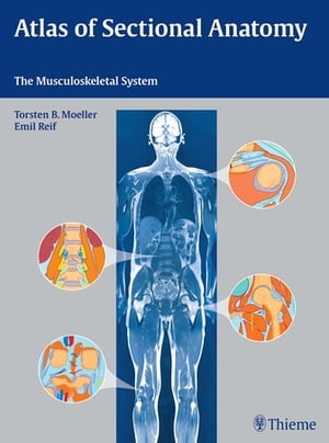 Atlas of Sectional Anatomy The Musculoskeletal System【電子書籍】[ Torsten Bert M?ller ]