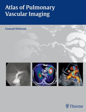 Atlas of Pulmonary Vascular Imaging