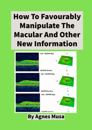 How To Favourably Manipulate The Macular And Other New Information
