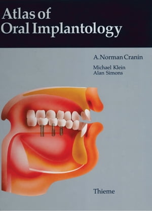 Atlas of Oral Implantology