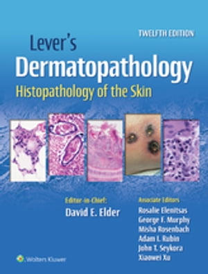 Lever 039 s Dermatopathology Histopathology of the Skin【電子書籍】 David E. Elder