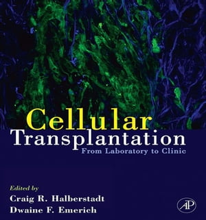 Cellular Transplantation