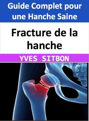 Fracture de la hanche : Guide Complet pour une Hanche Saine