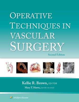 Operative Techniques in Vascular Surgery