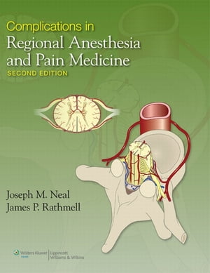 Complications in Regional Anesthesia and Pain Medicine【電子書籍】 Joseph Neal