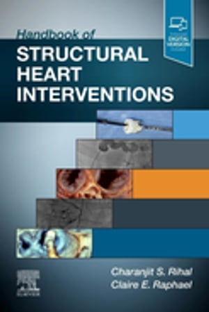 Handbook of Structural Heart Interventions, E-Book