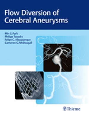 Flow Diversion of Cerebral Aneurysms