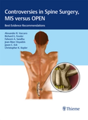 Controversies in Spine Surgery, MIS versus OPEN Best Evidence RecommendationsŻҽҡ