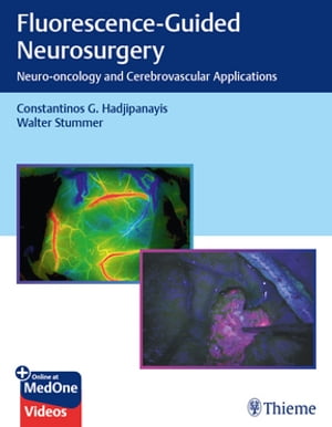 Fluorescence-Guided Neurosurgery