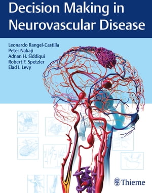 Decision Making in Neurovascular Disease