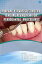 MINIMALLY INVASIVE SURGERY : A NOVEL APPROACH FOR PERIODONTAL PROCEDURES
