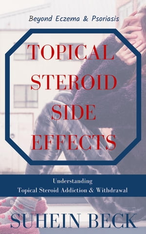 Topical Steroid Side Effects: Beyond Eczema and Psoriasis - Understanding Topical Steroid Addiction and Withdrawal