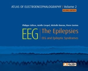 EEG - The Epilepsies