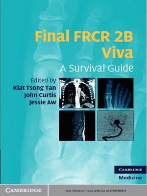 Final FRCR 2B Viva