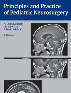 Principles and Practice of Pediatric Neurosurgery