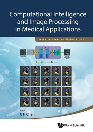 Computational Intelligence and Image Processing in Medical Applications