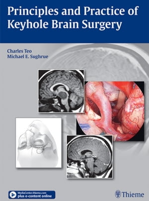 Principles and Practice of Keyhole Brain SurgeryŻҽҡ[ Charles Teo ]