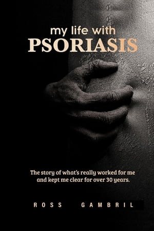 my life with PSORIASIS