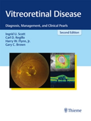 Vitreoretinal Disease Diagnosis, Management, and Clinical Pearls