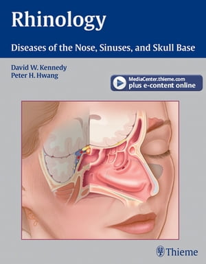 楽天楽天Kobo電子書籍ストアRhinology Diseases of the Nose, Sinuses, and Skull Base【電子書籍】[ David W. Kennedy ]