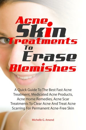 Acne Skin Treatments To Erase Acne Blemishes A Quick Guide To The Best Fast Acne Treatment, Medicated Acne Products, Acne Home Remedies, Acne Scar Treatments To Clear Acne And Treat Acne Scarring For Permanent Acne-Free Skin【電子書籍】