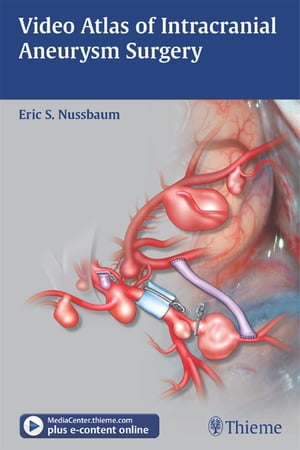 Video Atlas of Intracranial Aneurysm Surgery