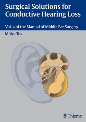 Surgical Solutions for Conductive Hearing Loss